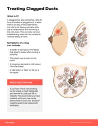 Preview image of Handout: Diagnosing and Treating Clogged Ducts